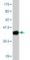 UBE2D3 Antibody (monoclonal) (M01)