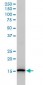 UBE2D3 Antibody (monoclonal) (M01)