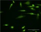 VAPA Antibody (monoclonal) (M01)