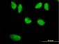 WRN Antibody (monoclonal) (M09)