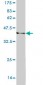 WRN Antibody (monoclonal) (M09)