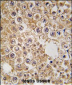 M6PR Antibody (N-term)