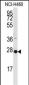 PPAP2C Antibody (C-term)