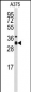 STX3 Antibody (Center)