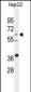 DHCR24 Antibody (Center)