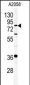 APEH Antibody (N-term)