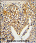 LUM Antibody (N-term)