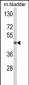 LUM Antibody (N-term)