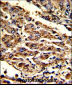 HOMER1 Antibody (N-term)