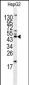 HOMER1 Antibody (N-term)