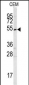 SMYD3 Antibody (Center)