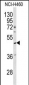 SERPINA4 Antibody (C-term)