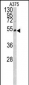 LUM Antibody (Center)