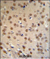 WTX Antibody (Center)