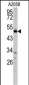 GAS7 Antibody (C-term)