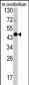 GAS7 Antibody (C-term)