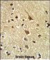 GLO1 Antibody (N-term)