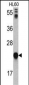 GLO1 Antibody (N-term)