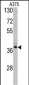 TALDO1 Antibody (Center)