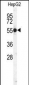 CTSH Antibody (N-term)