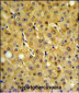 FBP1 Antibody (Center)