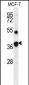 FBP1 Antibody (Center)