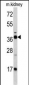 FBP1 Antibody (Center)