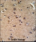 GGTLA1 Antibody (N-term)