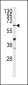 GGTLA1 Antibody (N-term)