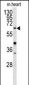 GGTLA1 Antibody (N-term)