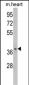 FBP2 Antibody (C-term)