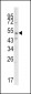 SMYD3 Antibody (N-term)