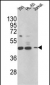 HSD17B7 Antibody (N-term)