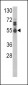 IL17RB Antibody (Center)