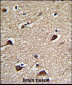 PGLS Antibody (C-term)