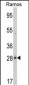 PGLS Antibody (C-term)