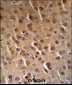 PFTK1 Antibody (N-term P82)