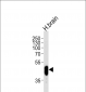 PFTK1 Antibody (N-term P82)