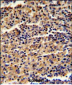 ALKBH8 Antibody (C-term)