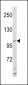 HIP116A Antibody (Center)