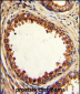 PTP4A2 Antibody (Center)