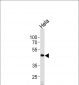 WSB2 Antibody (C-term)