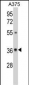 GALE Antibody (Center)