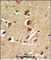 GNPAT Antibody (C-term)