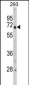 GNPAT Antibody (C-term)