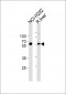 MCCC2 Antibody (Center)