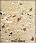 ND5 Antibody (C-term)