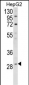 DIO1 Antibody (N-term)