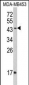 IFNGR2 Antibody (C-term)