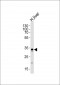 GPD1 Antibody (N-term)